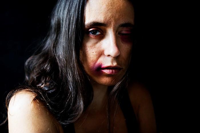 Mujer victima de violencia de genero