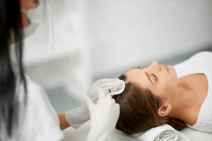 La bioestimulación con fibrina, en auge en el tratamiento contra la alopecia 