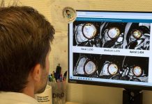 El Hospital Puerta de Hierro descarta enfermedad cardíaca en pacientes con hipertrabeculación del ventrículo izquierdo El Hospital Puerta de Hierro descarta enfermedad cardíaca en pacientes con hipertrabeculación del ventrículo izquierdo