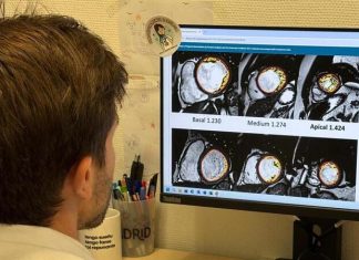 El Hospital Puerta de Hierro descarta enfermedad cardíaca en pacientes con hipertrabeculación del ventrículo izquierdo El Hospital Puerta de Hierro descarta enfermedad cardíaca en pacientes con hipertrabeculación del ventrículo izquierdo