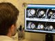 El Hospital Puerta de Hierro descarta enfermedad cardíaca en pacientes con hipertrabeculación del ventrículo izquierdo